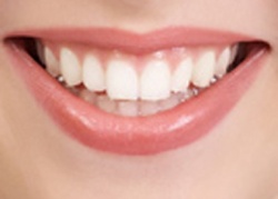 Win a Free Dental Implant Treatment